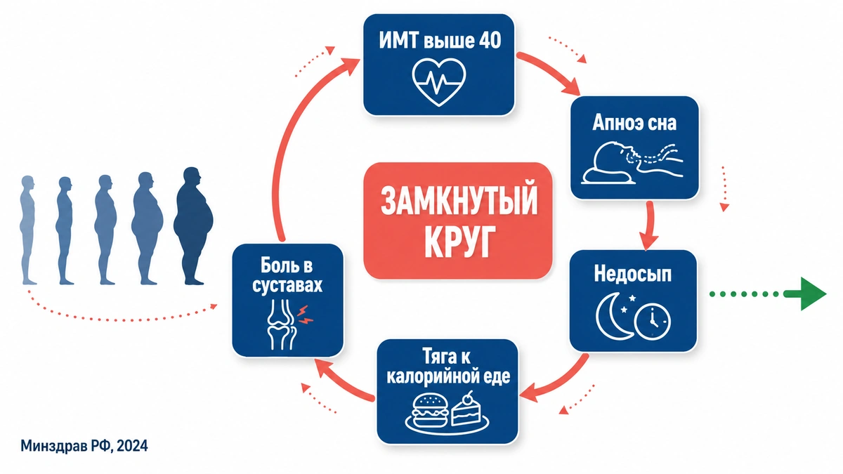 Осложнения при ИМТ выше 40 усиливают друг друга: каждое звено цепочки затрудняет снижение веса морбидное ожирение: схема развития осложнений от апноэ сна до диабета и артроза