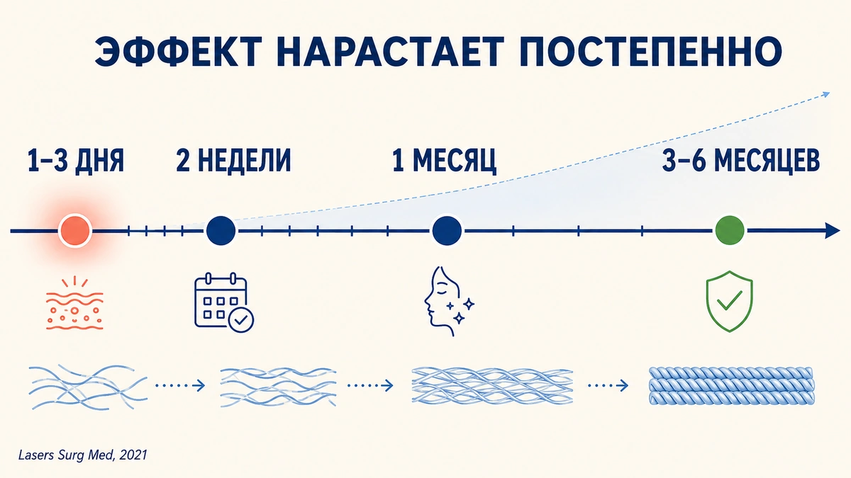 Сроки эффекта радиочастотного лифтинга: когда виден результат